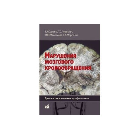 Нарушения мозгового кровообращения. Диагностика, лечение, профилактика