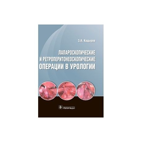 Лапароскопические и ретроперитонеоскопические операции в урологии