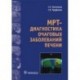 МРТ-диагностика очаговых заболеваний печени