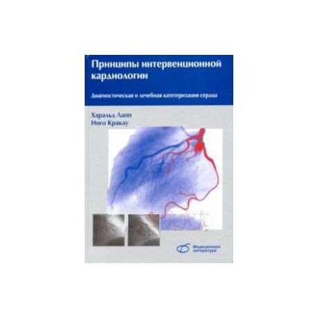 Принципы интервенционной кардиологии. Диагностическая и лечебная катетеризация сердца