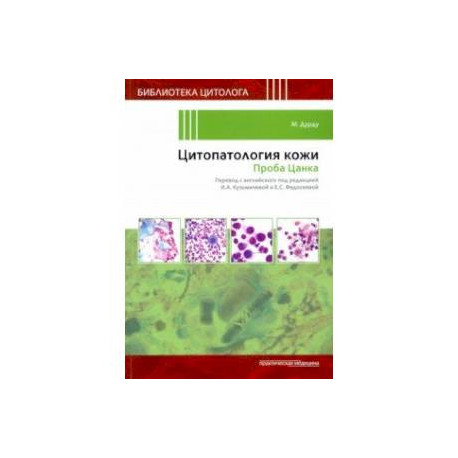 Цитопатология кожи. Проба Цанка