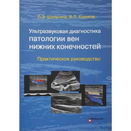 Ультразвуковая диагностика патологии вен нижних конечностей: практическое руководство