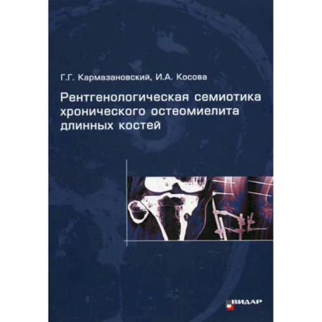 Рентгенологическая семиотика хронического остеомиелита длинных костей