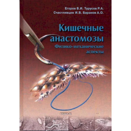 Кишечные анастомозы. Физико-механические аспекты