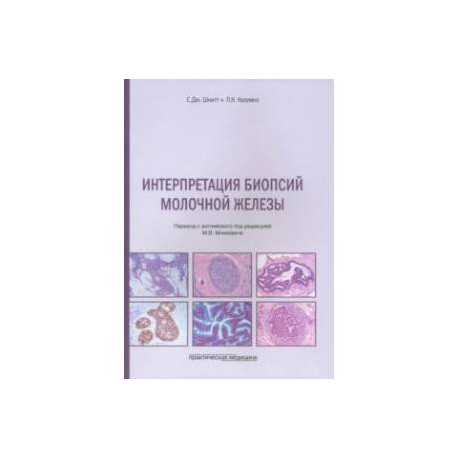 Интерпретация биопсий молочной железы