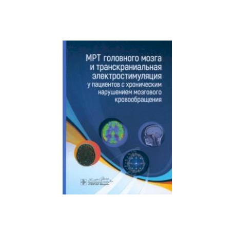 МРТ головного мозга и транскраниальная электростимуляция у пациентов с хроническим нарушением