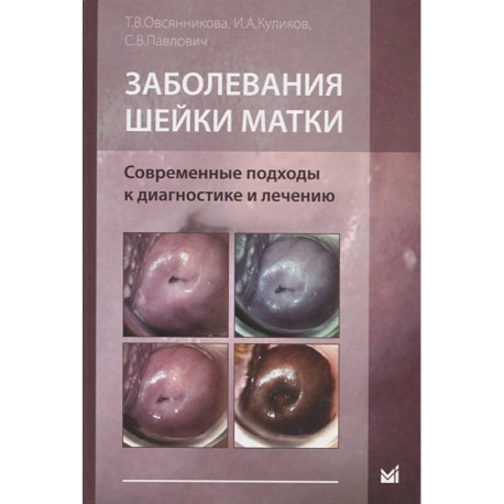 Заболевания шейки матки. Современные подходы к диагностике и лечению