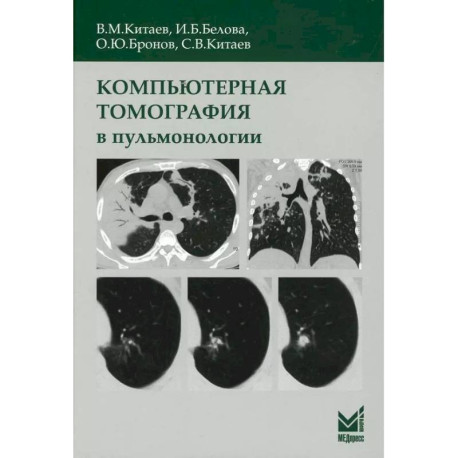 Компьютерная томография в пульмонологии