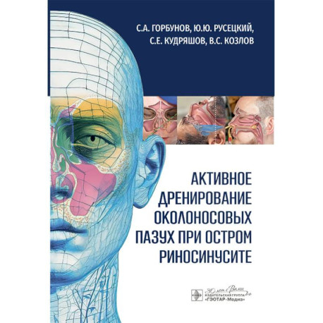 Активное дренирование околоносовых пазух при остром риносинусите