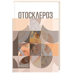 Отосклероз