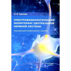 Электрофизиологический мониторинг центральной нервной системы