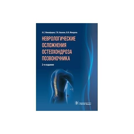 Неврологические осложнения остеохондроза позвоночника.